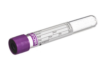 EDTA Blut